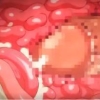 Thumbnail of related posts 101