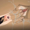Thumbnail of related posts 005